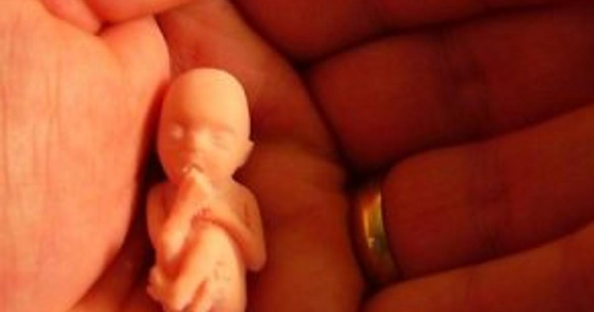 9 недель фото 9 недель фото