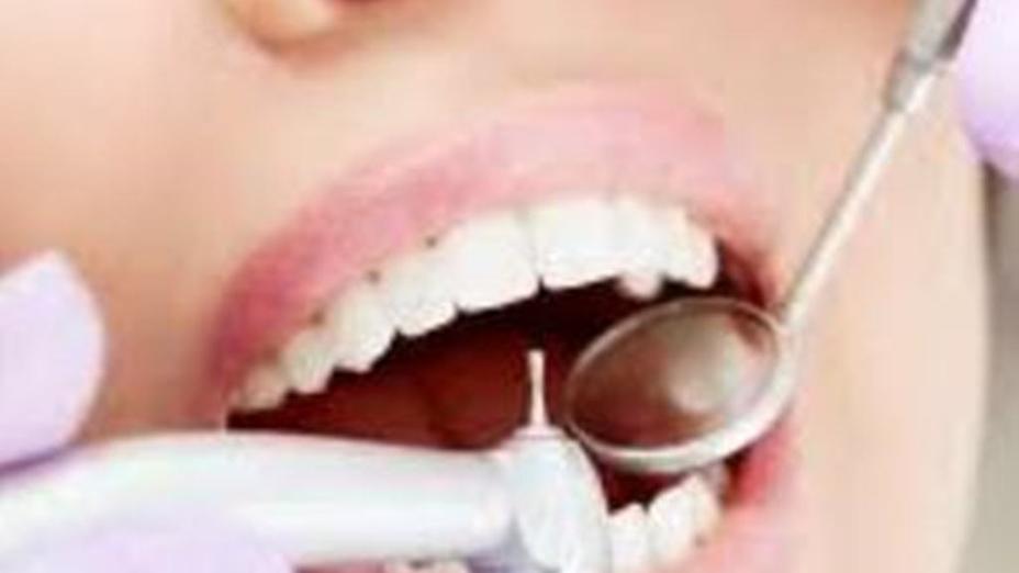 Ғалымдар тісті емдеудің жаңа технологиясын ойлап тапты